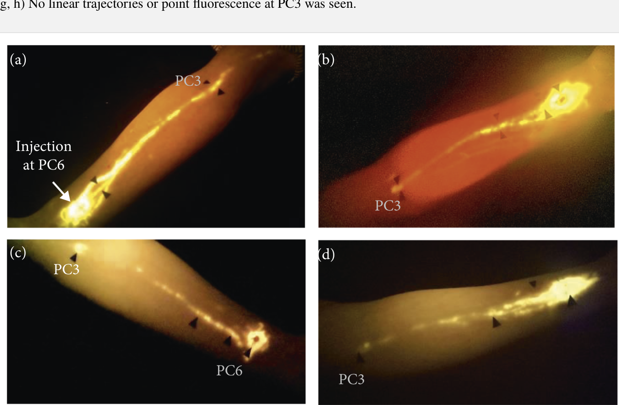 Variations in fluorescein migratory paths.