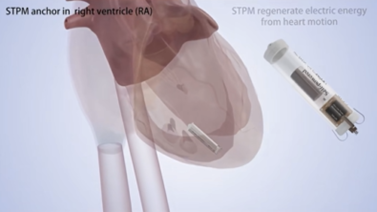 A miniature self-powered cardiac pacemaker – towards lifelong maintenance-free pacing